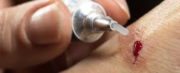 Apply an Antibacterial Ointment: