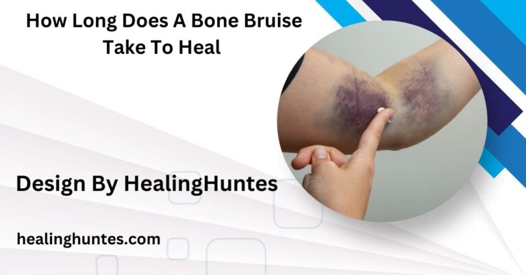 How Long Does A Bone Bruise Take To Heal - Symptoms, Recovery Time, and Care!